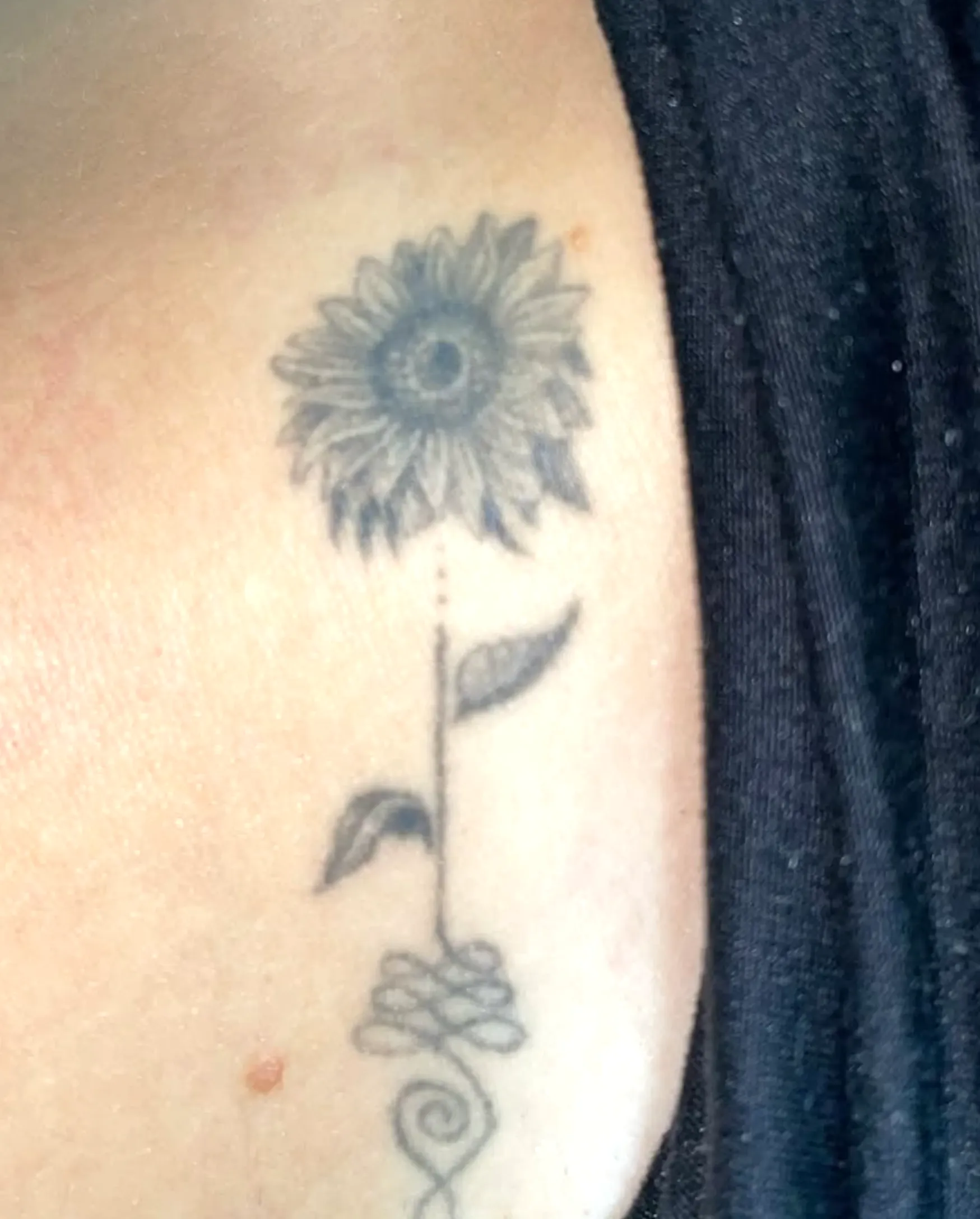 acetone tattoo removal