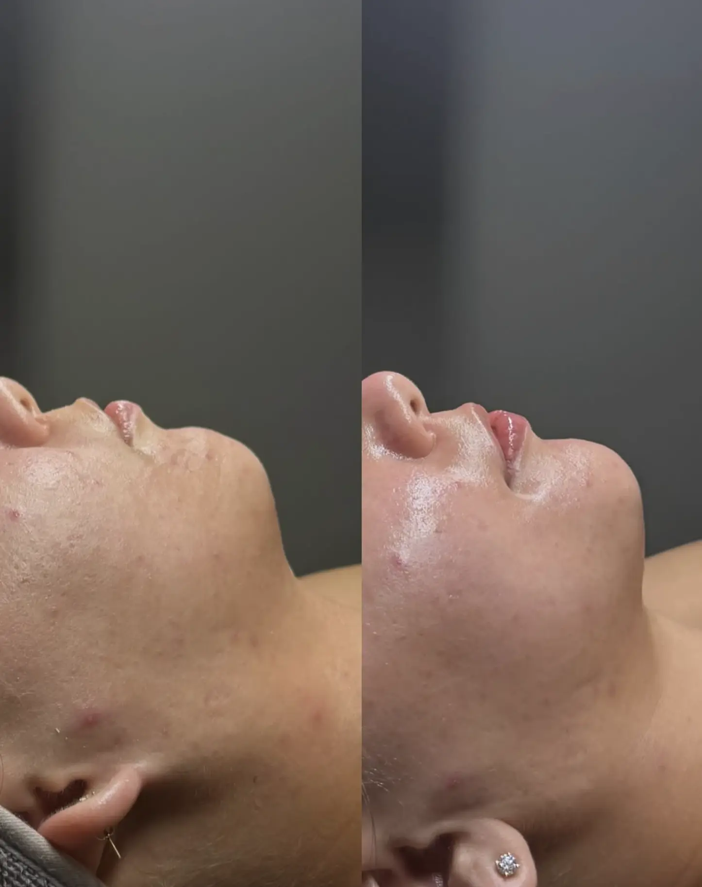 what is buccal facial massage