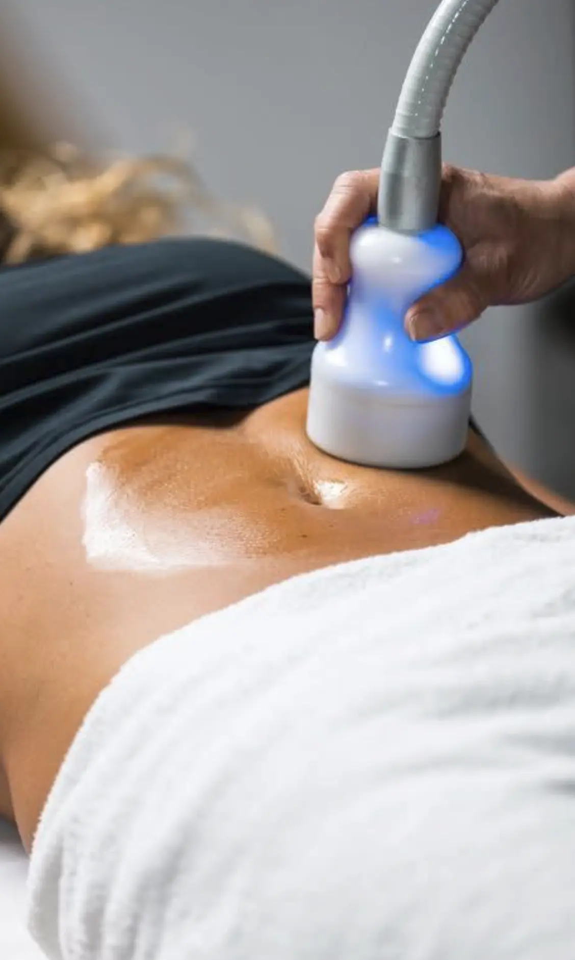 cryo treatment brisbane