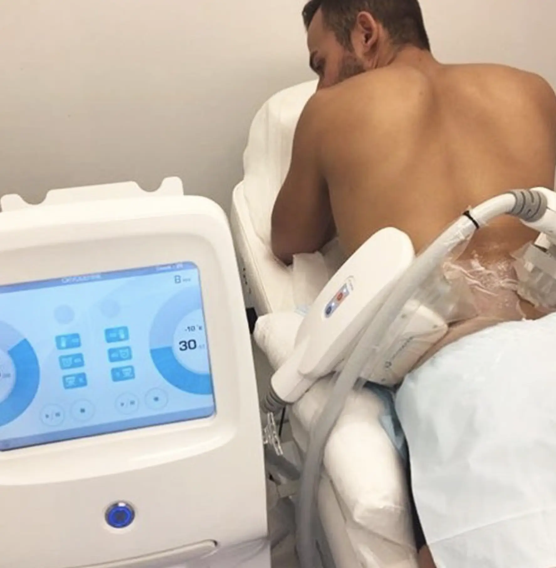 cryoskin slimming reviews