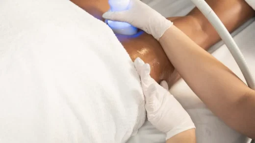 what is cryoskin therapy